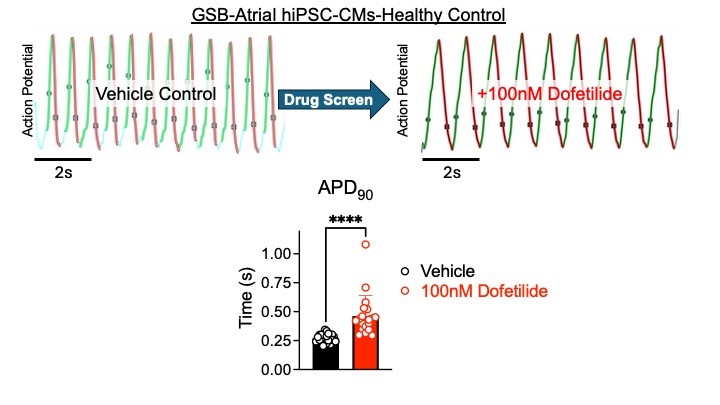 Human iPSC-derived Atrial Cardiomyocytes