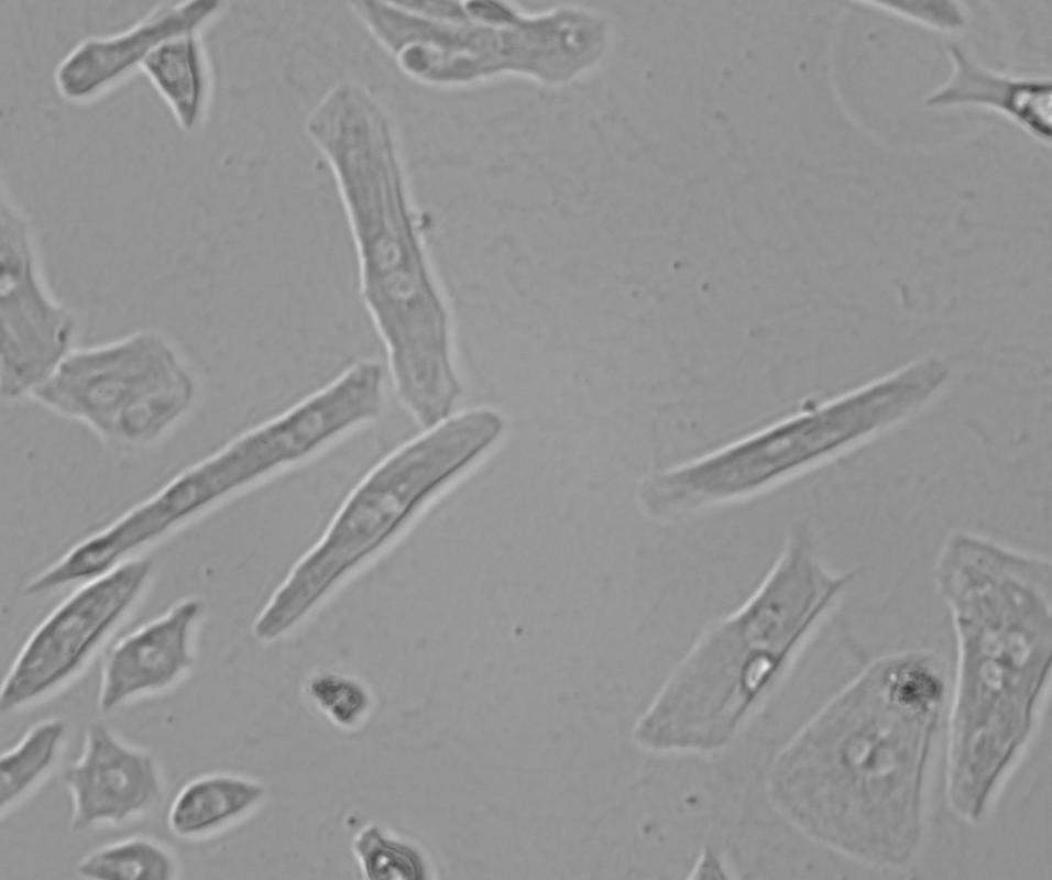 Ventricular Cardiomyocytes
