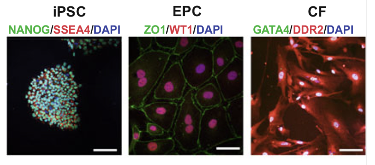 Human iPSC-derived Fibroblasts