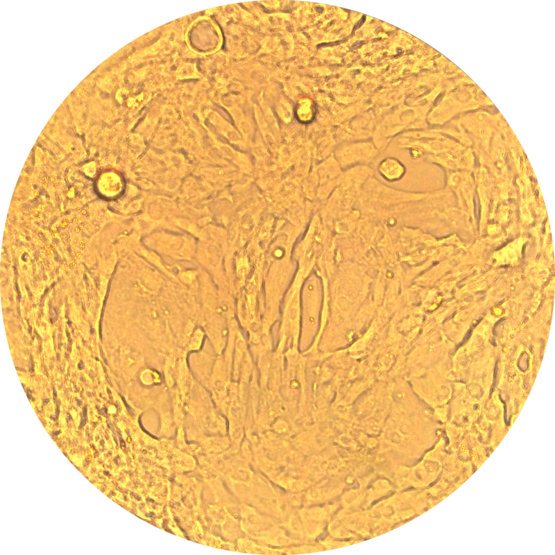Atrial Cardiomyocytes