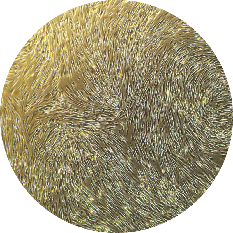Fibroblasts